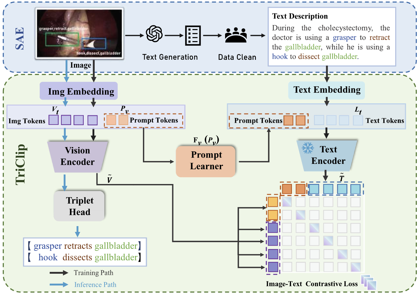 Understanding Surgical Triplet Videos Through Transferable Visual Models from Natural Language Supervision